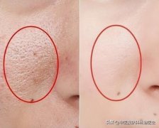 刷手臂经络怎么刷的(刷手臂经络怎么刷的好看)