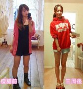 做运动瘦腿会反弹吗(运动瘦的会反弹吗)