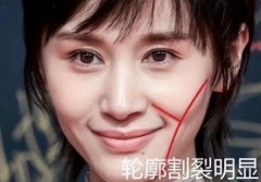 脸蛋怎么瘦(脸部怎样瘦)