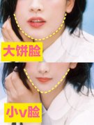 怎么瘦重下巴(怎样减重下巴)