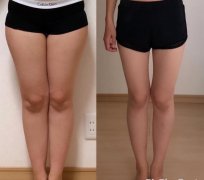 减大腿的快方法(怎么减大腿快)