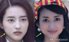 脸好大怎么减肥方法如下(肥胖脸大怎么减肥)