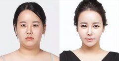 怎样健康瘦脸方法(怎样健康瘦脸方法有)
