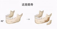 怎么瘦下巴下面(怎么瘦下巴下面的脂肪)