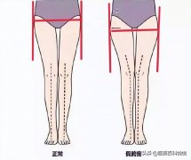 假胯怎么瘦图片(假胯怎么减肥)