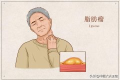 手臂根部粗怎么减图片(胳膊根子粗怎么减)