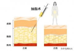 减肥法有什么好方法(减肥的方法有几种方法)