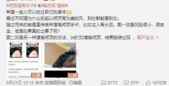常州上眼皮吸脂价格多少(上眼皮抽脂多少钱)
