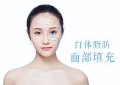 脸部吸脂多少热敷(脸部吸脂多少热敷好)