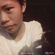 面部吸脂做多少次(面部吸脂做几次)