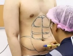 泫雅小腿吸脂价格多少啊(泫雅小腿吸脂价格多少啊知乎)