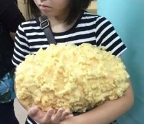 吸脂手术十斤大概多少钱(手术吸脂10斤)