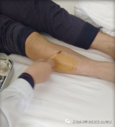 青岛眼部吸脂减肥价格多少(青岛抽脂价格)